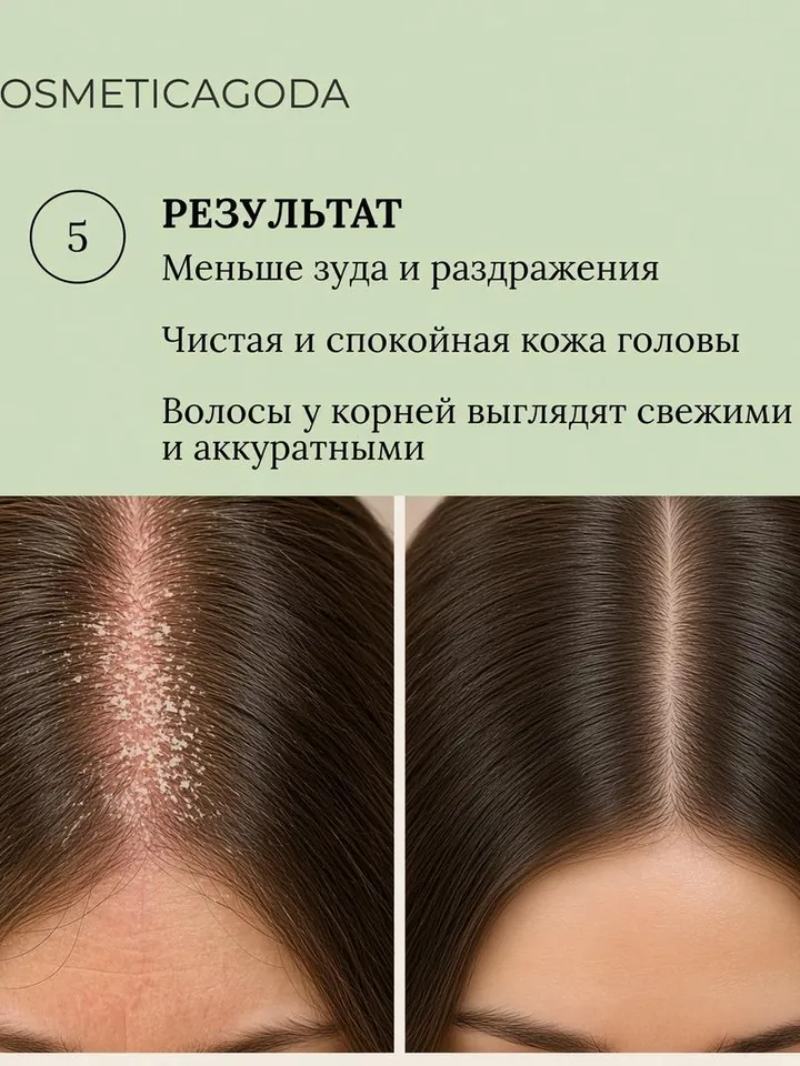 Спрей от псориаза и дерматита для кожи головы с экстрактом красного клевера, 100 мл — фото 4